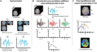 Separating neuronal activity and systemic low-frequency oscillation related BOLD responses at nodes of the default mode network during resting-state fMRI with multiband excitation echo-planar imaging